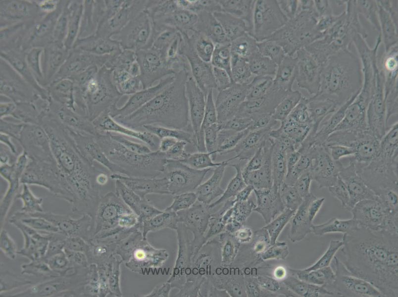 SW 1353 (人軟骨肉瘤細胞) (STR鑒定正確)