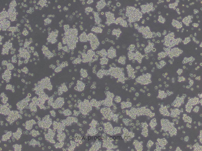 L5178Y TK+/- clone(3.7.2C) (小鼠淋巴瘤細(xì)胞) (STR鑒定正確)