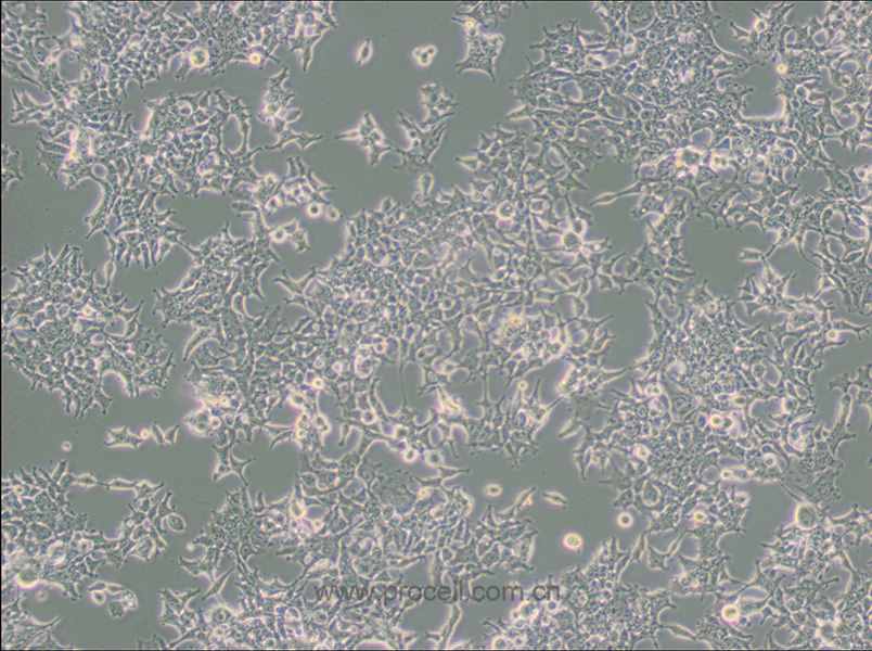 293T/17 (人胚腎細(xì)胞) (STR鑒定正確)