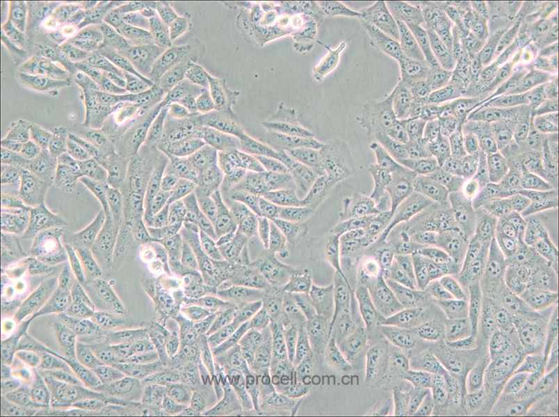 MNNG/HOS Cl #5 [R-1059-D] (人骨肉瘤細胞) (STR鑒定正確)