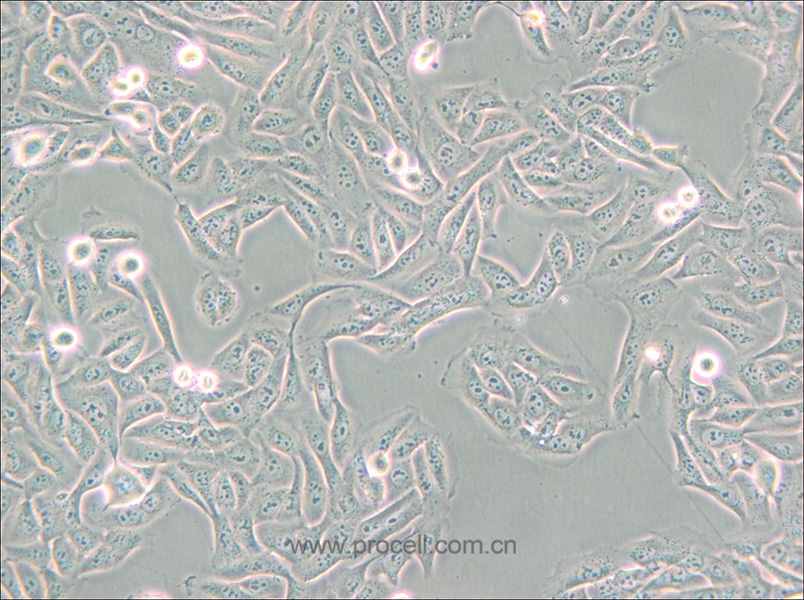 MNNG/HOS Cl #5 [R-1059-D] (人骨肉瘤細胞) (STR鑒定正確)