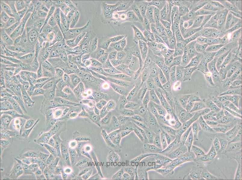 MNNG/HOS Cl #5 [R-1059-D] (人骨肉瘤細胞) (STR鑒定正確)