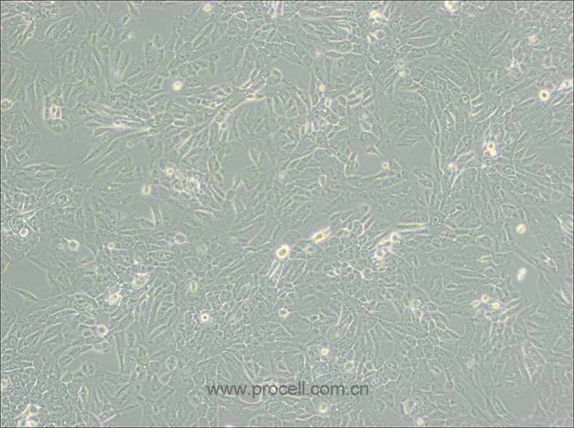 MCF 10A (人正常乳腺上皮細胞) (STR鑒定正確)