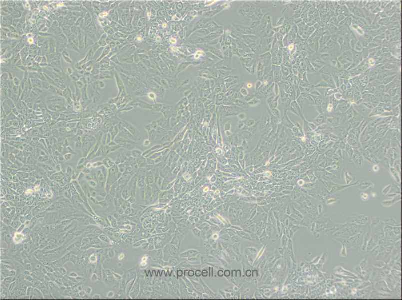 MCF 10A (人正常乳腺上皮細胞) (STR鑒定正確)