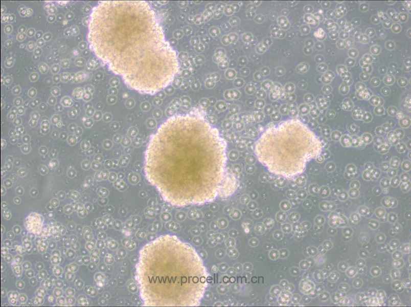 NK-92 (人惡性非霍奇金淋巴瘤患者的自然殺傷細胞) (STR鑒定正確)