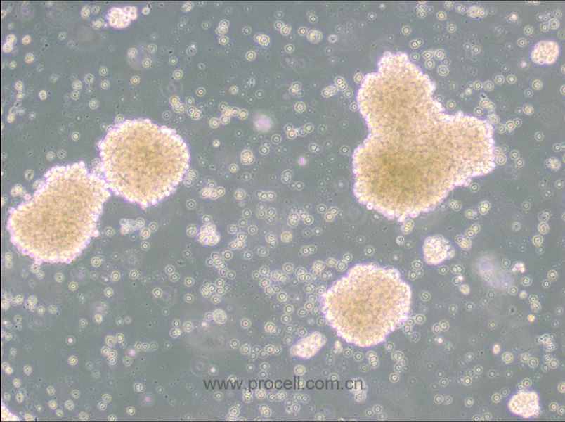 NK-92 (人惡性非霍奇金淋巴瘤患者的自然殺傷細(xì)胞) (STR鑒定正確)