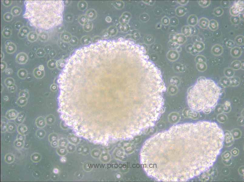 NK-92 (人惡性非霍奇金淋巴瘤患者的自然殺傷細(xì)胞) (STR鑒定正確)