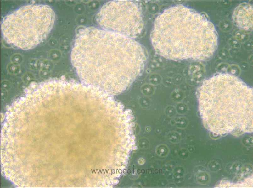 NK-92 (人惡性非霍奇金淋巴瘤患者的自然殺傷細(xì)胞) (STR鑒定正確)