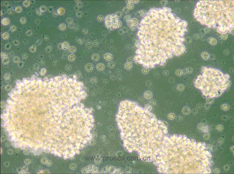 NK-92 (人惡性非霍奇金淋巴瘤患者的自然殺傷細(xì)胞) (STR鑒定正確)