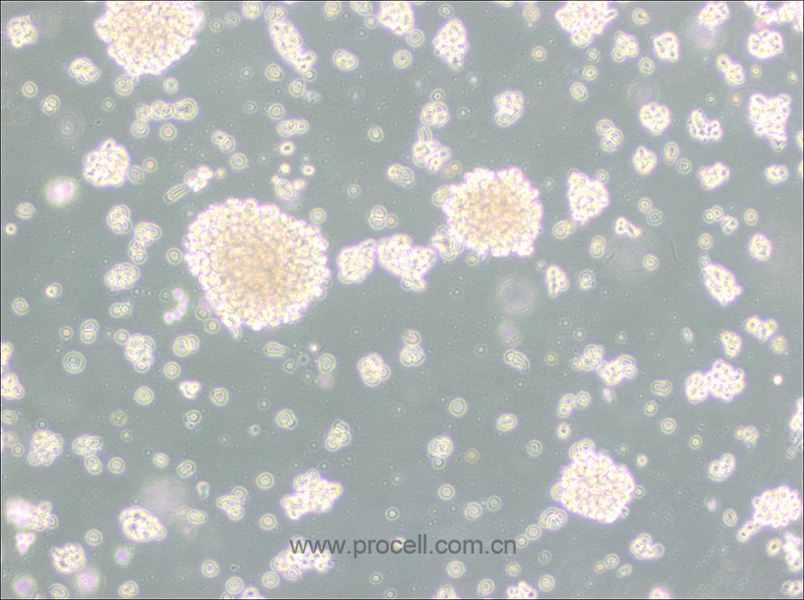 NK-92MI (人惡性非霍奇金淋巴瘤患者的自然殺傷細(xì)胞) (STR鑒定正確)