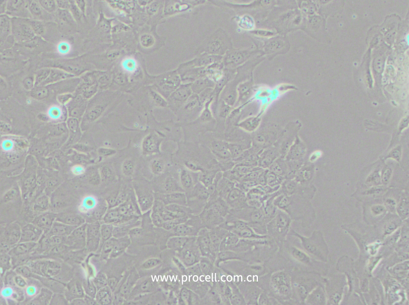 SCC-9 [SCC 9; SCC9] (人舌鱗癌細胞) (STR鑒定正確)