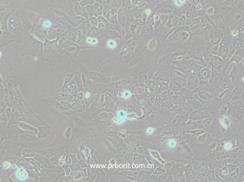 SCC-9 [SCC 9; SCC9] (人舌鱗癌細胞) (STR鑒定正確)