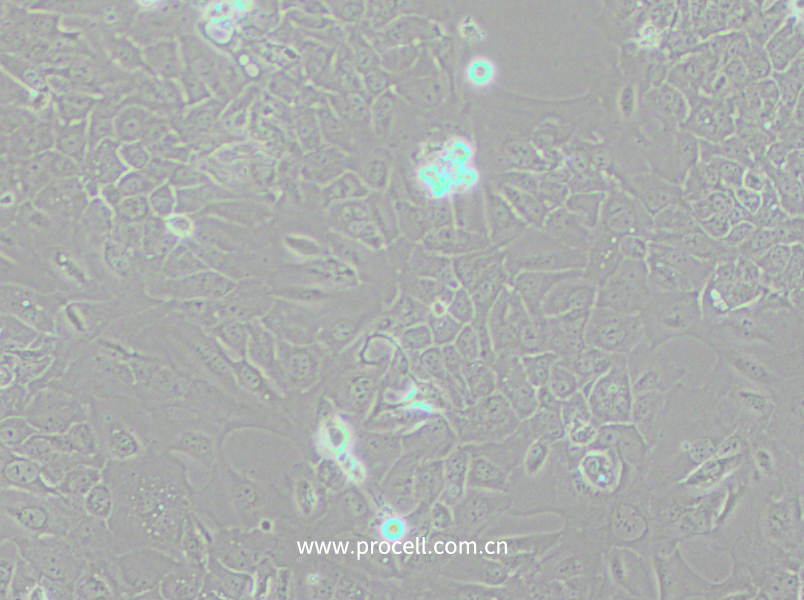 SCC-9 [SCC 9; SCC9] (人舌鱗癌細胞) (STR鑒定正確)