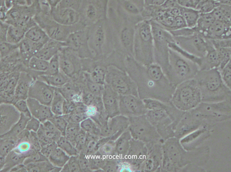 SCC-9 [SCC 9; SCC9] (人舌鱗癌細胞) (STR鑒定正確)