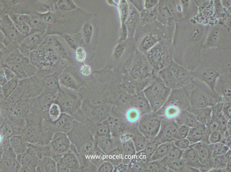 SCC-9 [SCC 9; SCC9] (人舌鱗癌細胞) (STR鑒定正確)