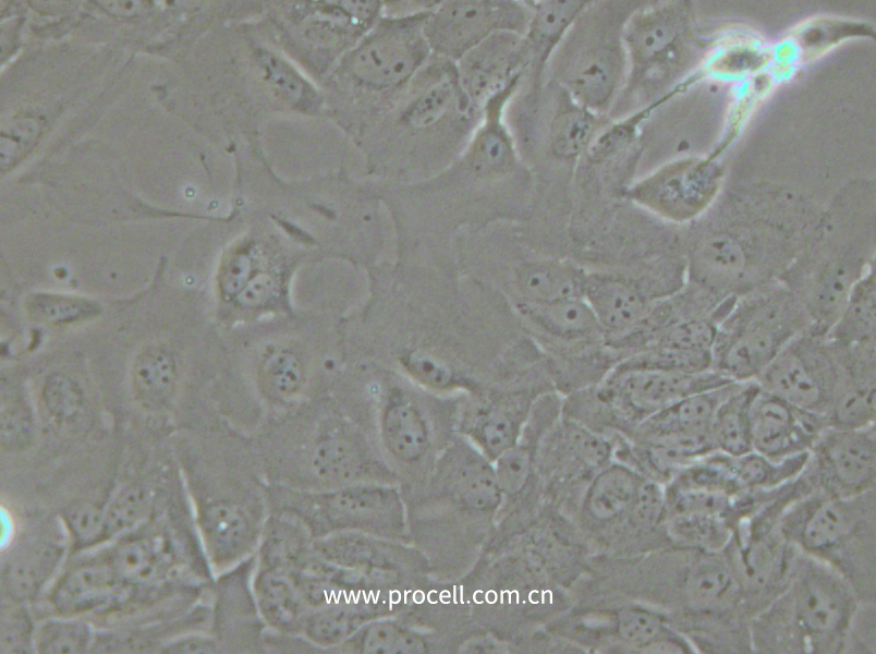 SCC-9 [SCC 9; SCC9] (人舌鱗癌細胞) (STR鑒定正確)