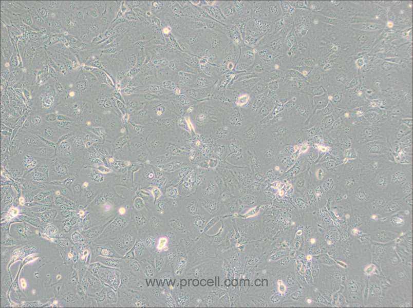 NCI-H2347 (人肺癌細(xì)胞) (STR鑒定正確)