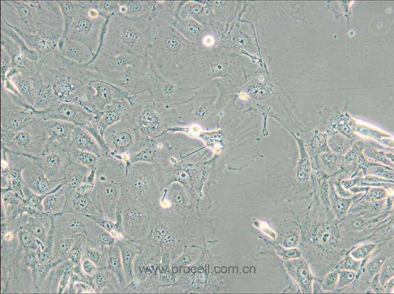 NCI-H2347 (人肺癌細(xì)胞) (STR鑒定正確)