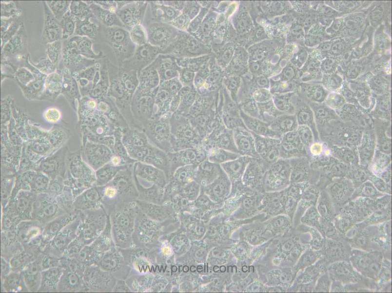 BHT101 (人甲狀腺癌細(xì)胞(未分化)) (STR鑒定正確)