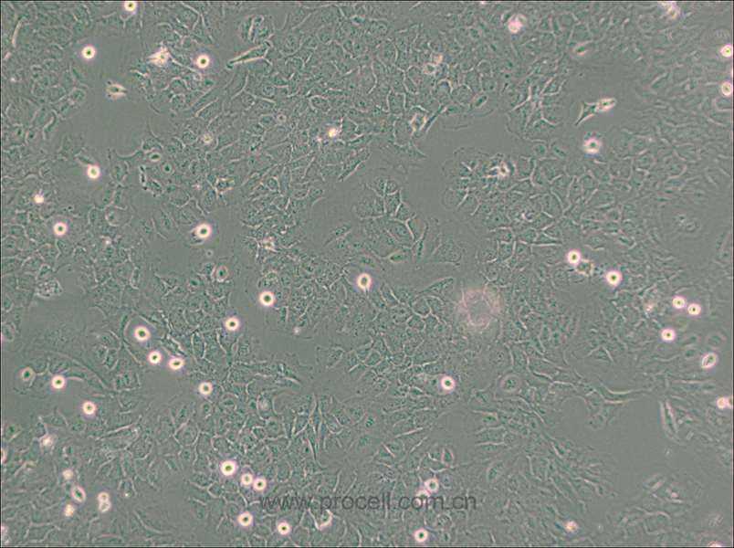 HMC3 (人小膠質(zhì)細(xì)胞) (STR鑒定正確)