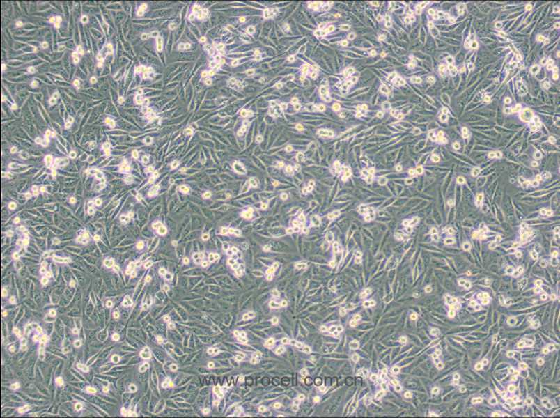 MDA-MB-231/GFP (人乳腺癌細(xì)胞(綠色熒光蛋白標(biāo)記) (STR鑒定正確)