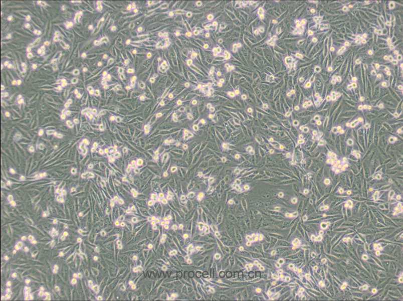 MDA-MB-231/GFP (人乳腺癌細(xì)胞(綠色熒光蛋白標(biāo)記) (STR鑒定正確)