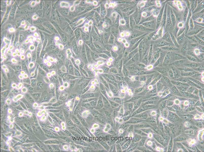 MDA-MB-231/GFP (人乳腺癌細(xì)胞(綠色熒光蛋白標(biāo)記) (STR鑒定正確)