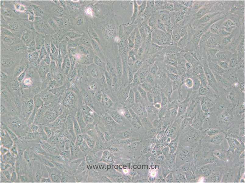 PUMC-HUVEC-T1 (SV40T轉(zhuǎn)化人臍靜脈內(nèi)皮細胞) (STR鑒定正確)