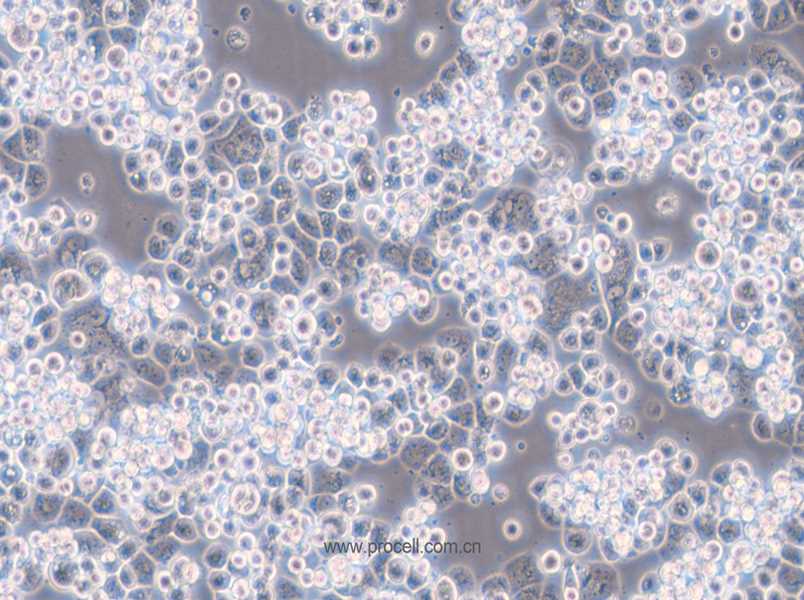 MDA-kb2 (人乳腺癌細胞)  (STR鑒定正確)