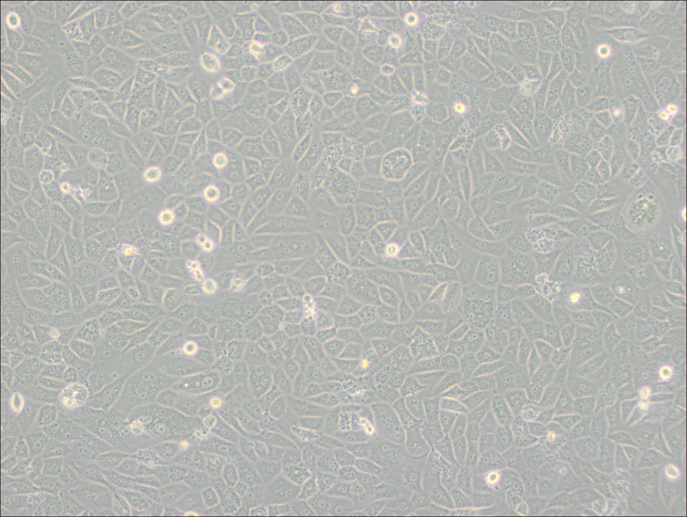 SK-LU-1 (人低分化肺腺癌細(xì)胞) (STR鑒定正確)