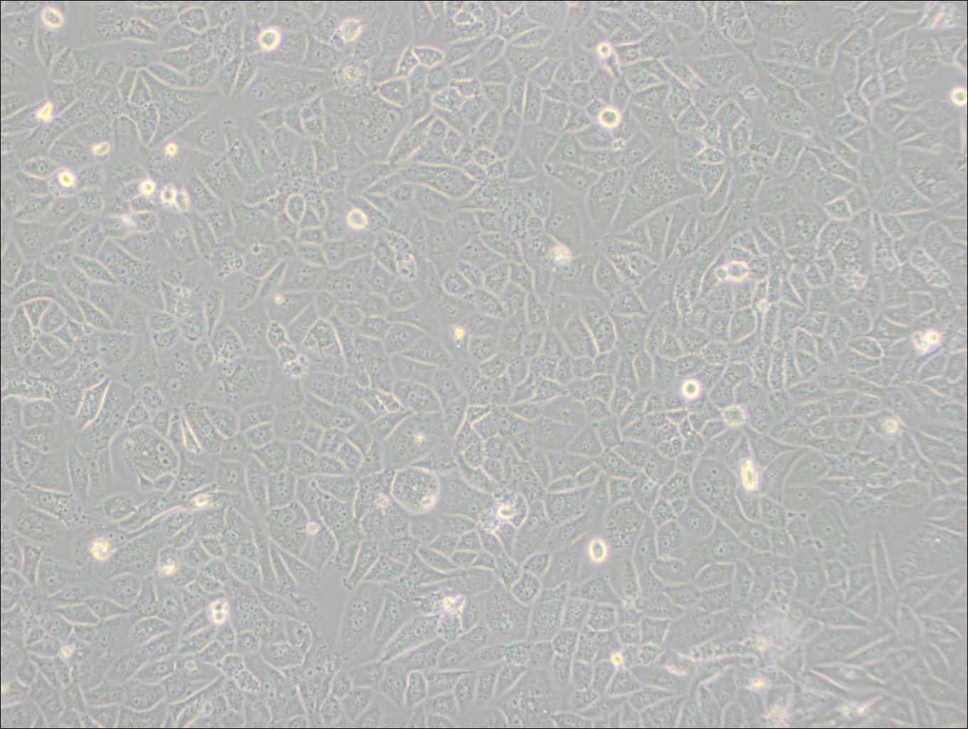 SK-LU-1 (人低分化肺腺癌細胞) (STR鑒定正確)