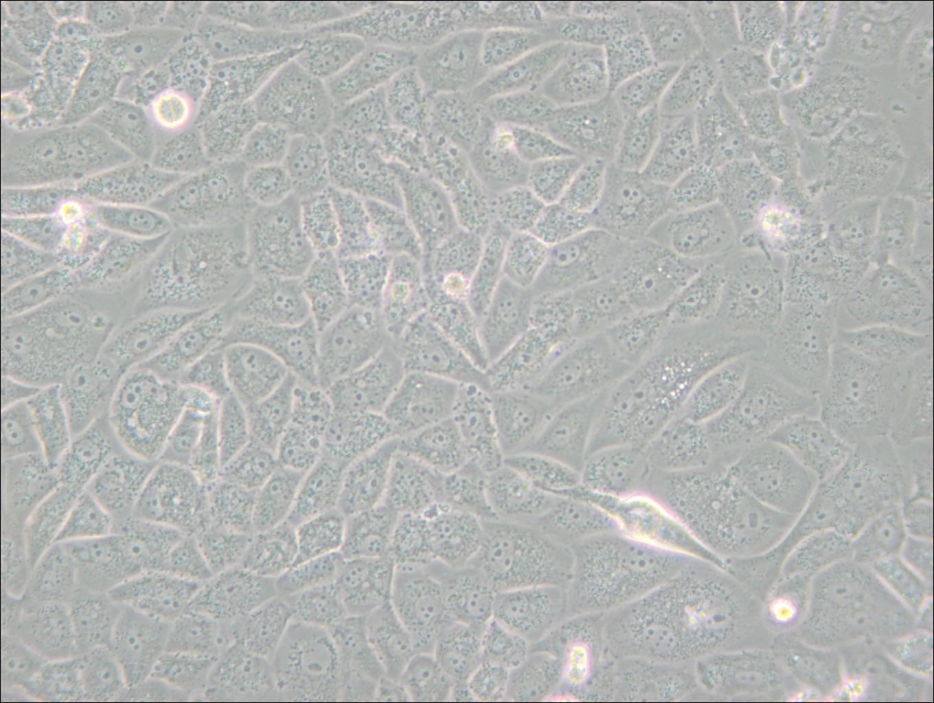 SK-LU-1 (人低分化肺腺癌細胞) (STR鑒定正確)