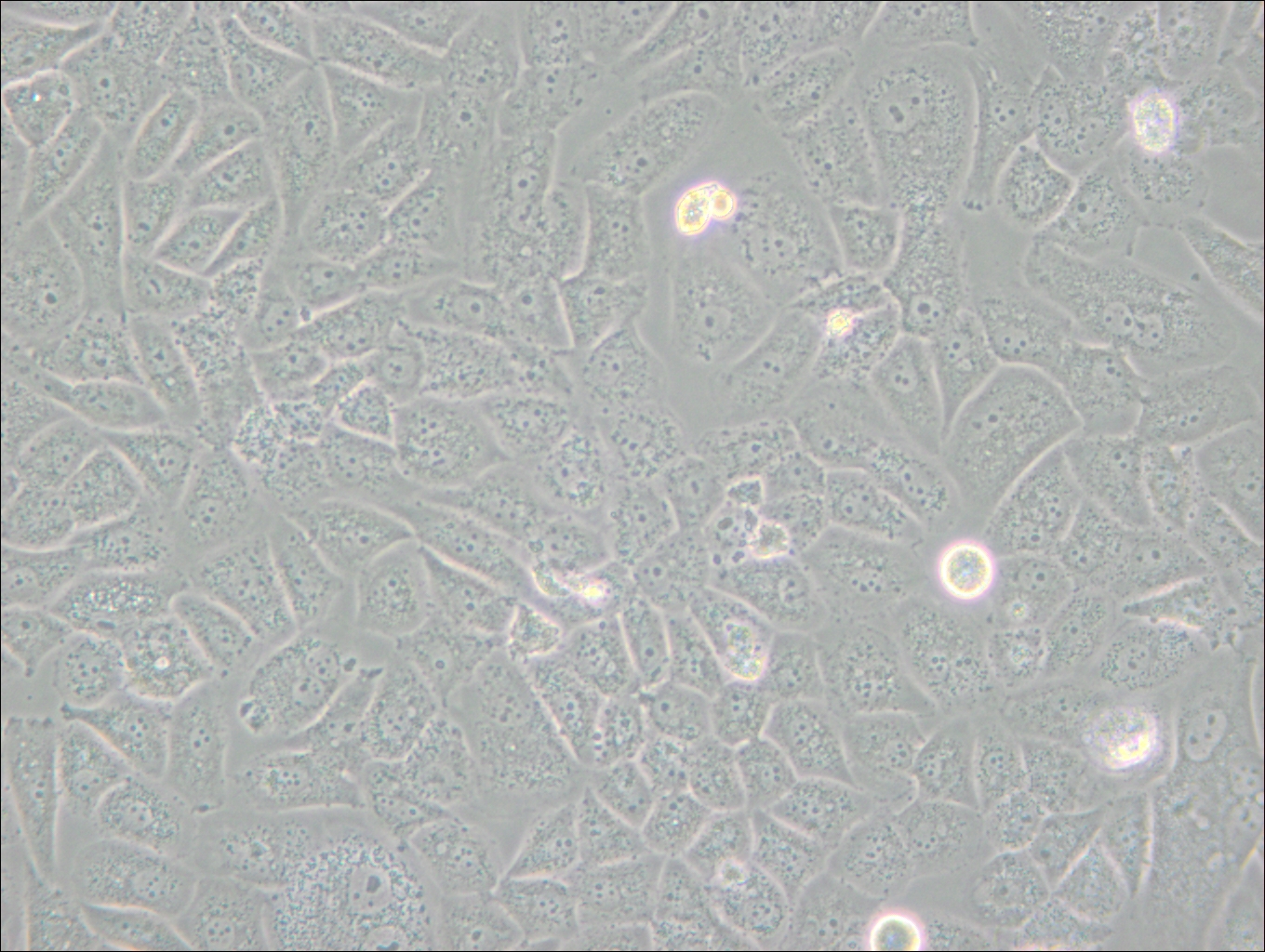 SK-LU-1 (人低分化肺腺癌細胞) (STR鑒定正確)