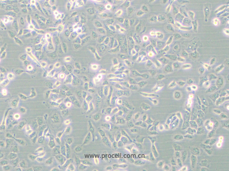 SUM149PT (人乳腺癌細(xì)胞) (STR鑒定正確)