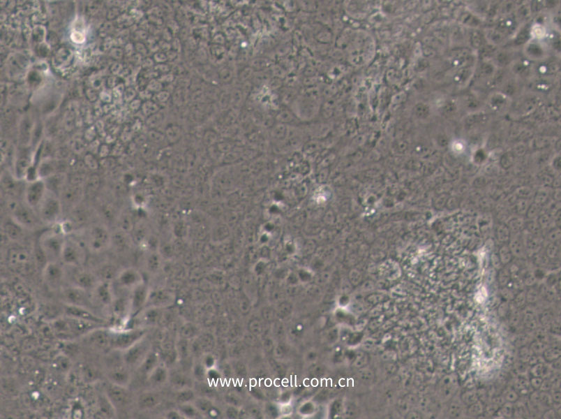 SW1463 (人大腸癌細(xì)胞) (STR鑒定正確)