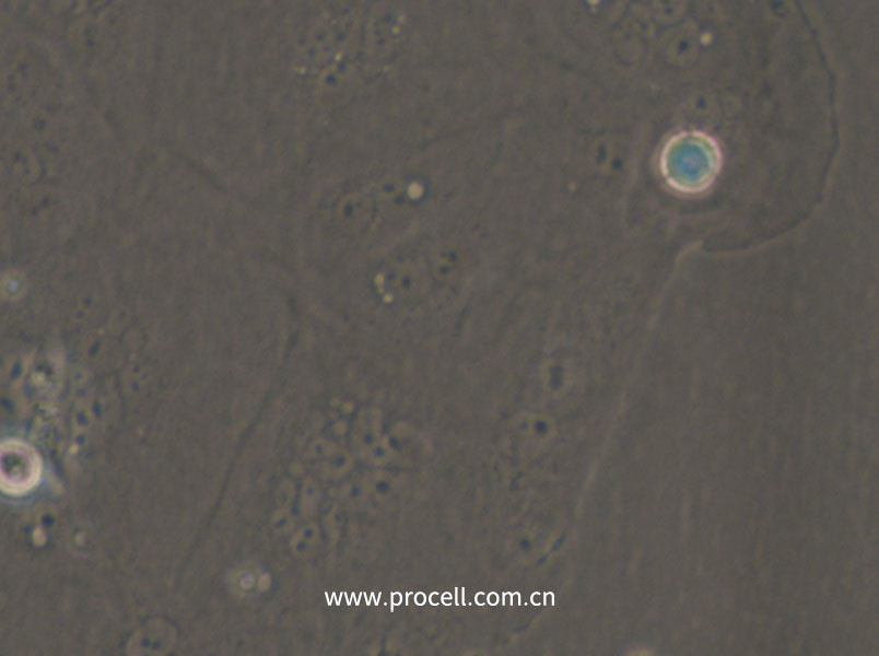 SW1463 (人大腸癌細(xì)胞) (STR鑒定正確)