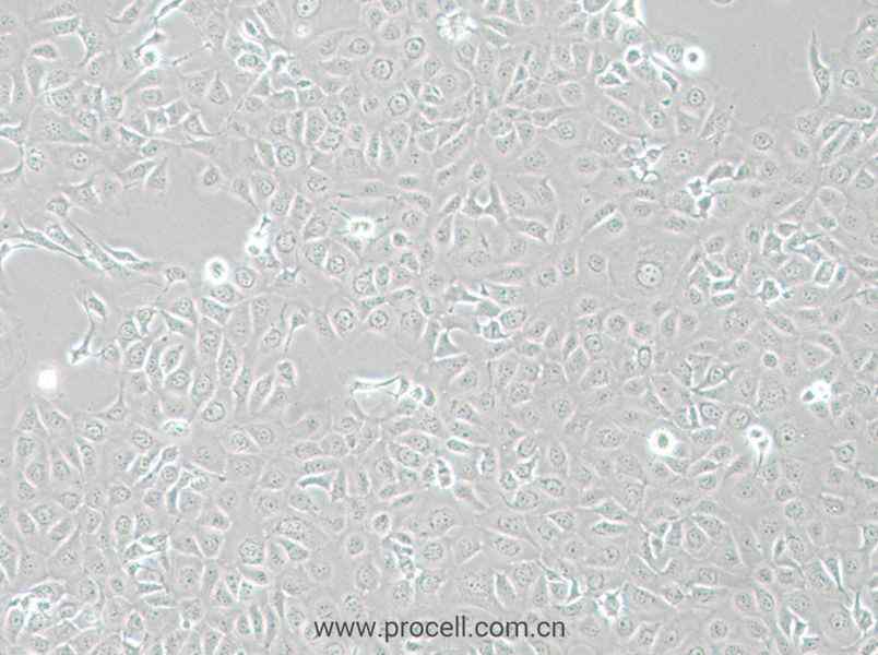 HCE-T (人角膜上皮細(xì)胞) (STR鑒定正確)