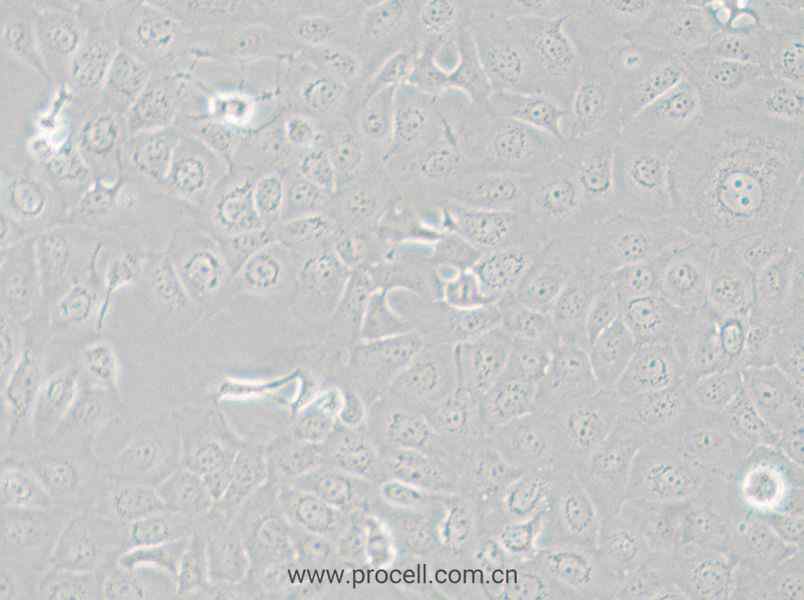 HCE-T (人角膜上皮細(xì)胞) (STR鑒定正確)