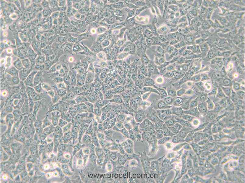 SN12C (人腎癌細(xì)胞) (STR鑒定正確)