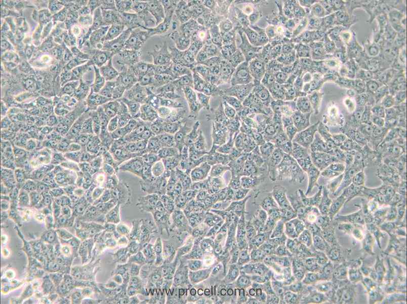 SN12C (人腎癌細(xì)胞) (STR鑒定正確)