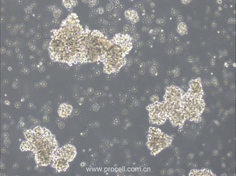 OCI-Ly3 (人彌漫大 B 細胞淋巴瘤細胞) (STR鑒定正確)