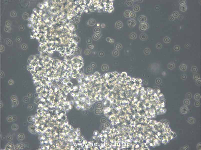 OCI-Ly3 (人彌漫大 B 細胞淋巴瘤細胞) (STR鑒定正確)