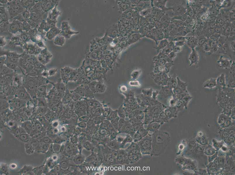 NCI-H1573 (人肺癌腺癌細(xì)胞) (STR鑒定正確)