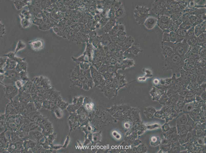 NCI-H1573 (人肺癌腺癌細(xì)胞) (STR鑒定正確)