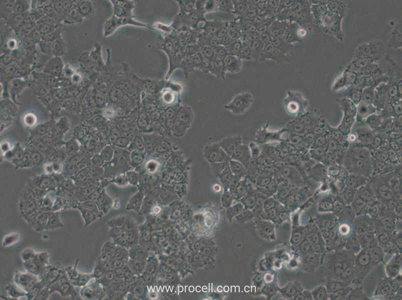 NCI-H1573 (人肺癌腺癌細(xì)胞) (STR鑒定正確)