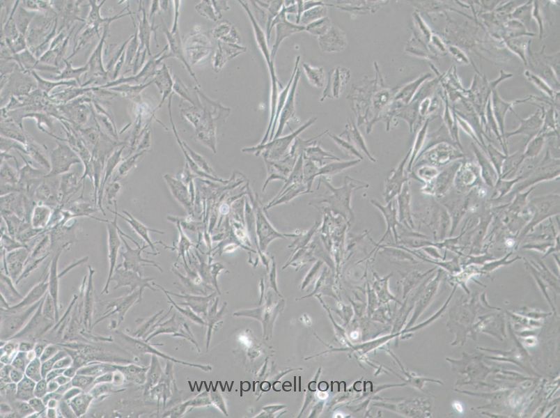 NCI-H1648 (人肺癌腺癌細(xì)胞) (STR鑒定正確)