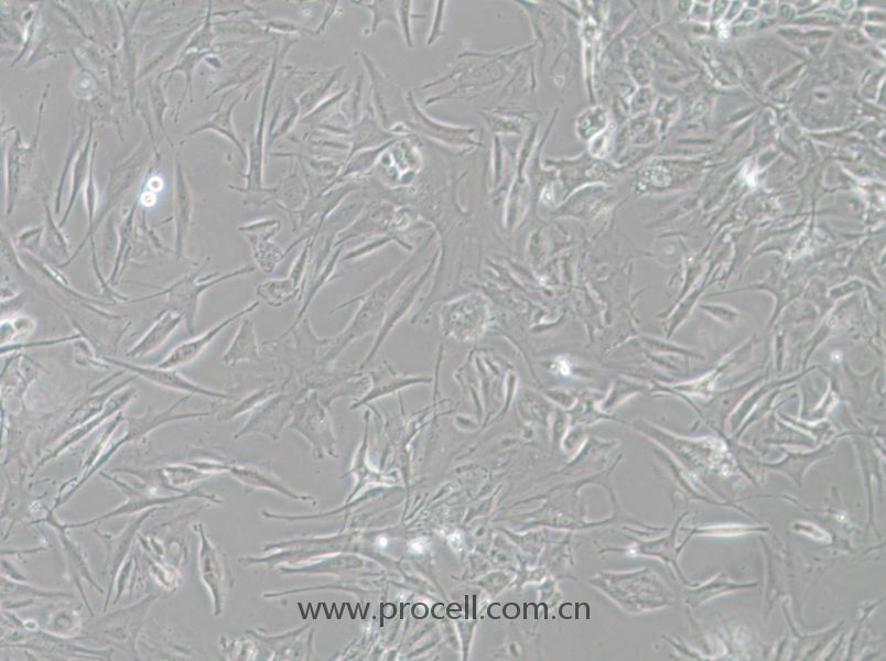 NCI-H1648 (人肺癌腺癌細(xì)胞) (STR鑒定正確)