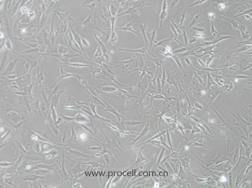 NCI-H1648 (人肺癌腺癌細(xì)胞) (STR鑒定正確)