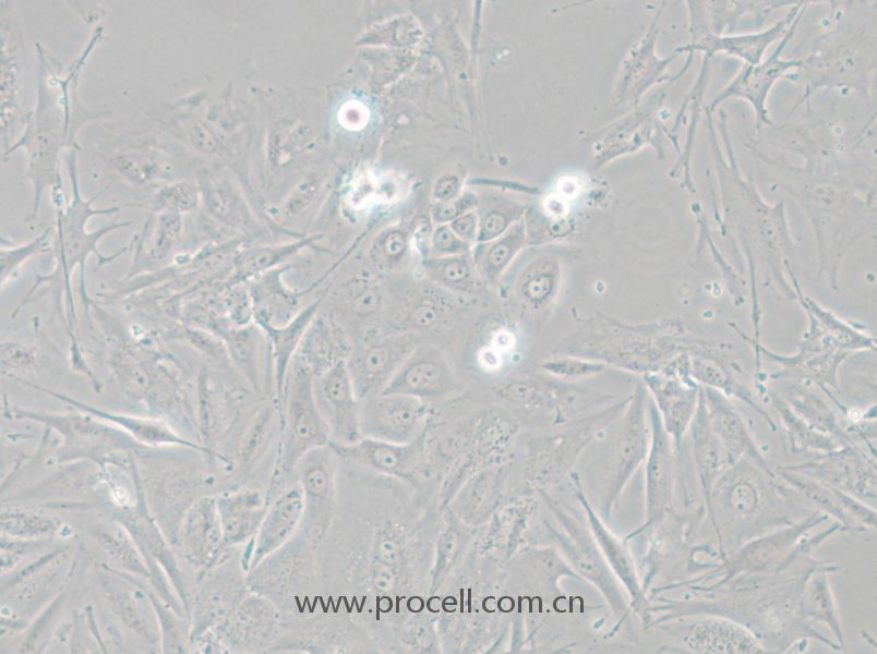 NCI-H1648 (人肺癌腺癌細(xì)胞) (STR鑒定正確)