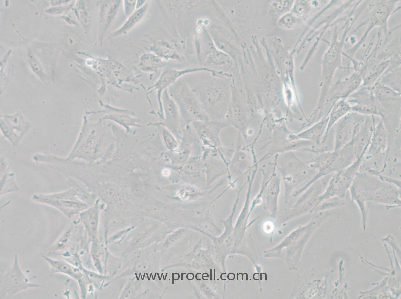 NCI-H1648 (人肺癌腺癌細(xì)胞) (STR鑒定正確)